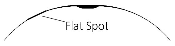 Flat Spot